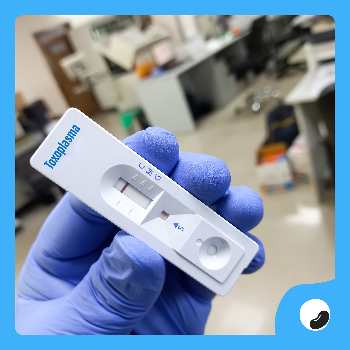 Toxoplasma Test