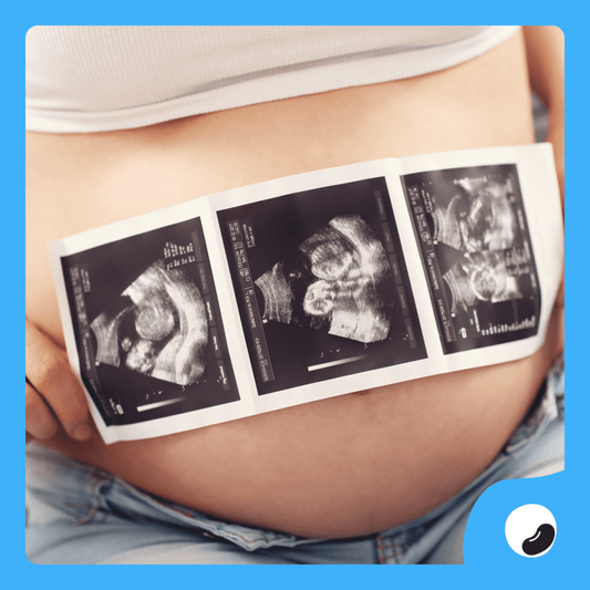 2D Pregnancy Ultrasound - Print