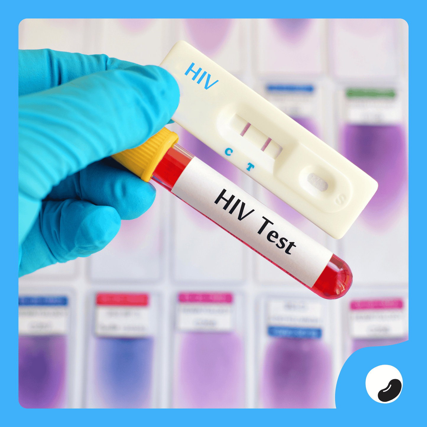 Pemeriksaan Anti HIV