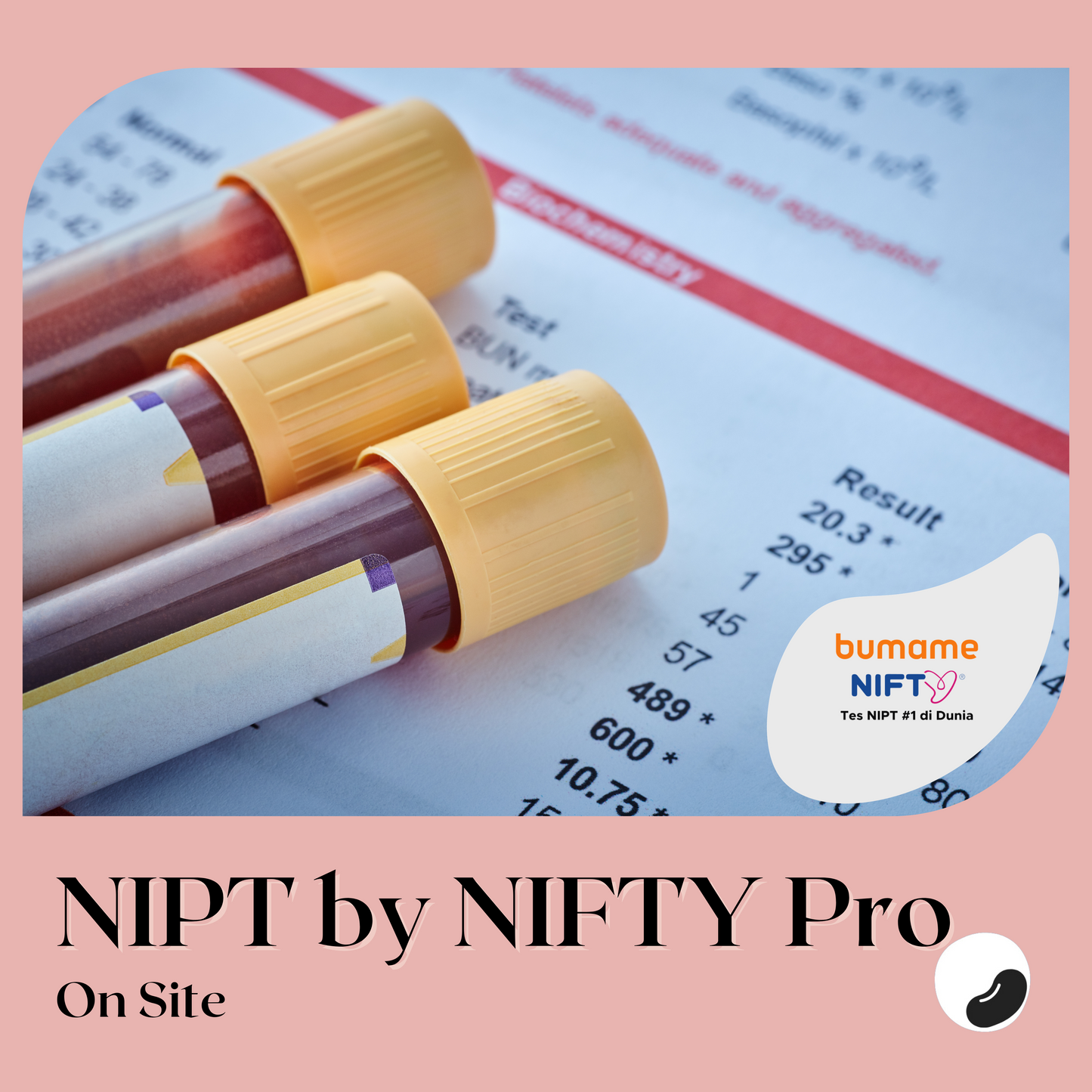 NIPT Test by NIFTY Pro (On ​​Site)
