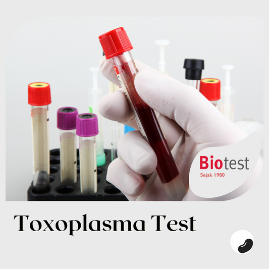 Toxoplasma - Test