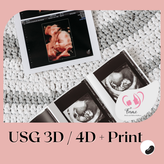 Ultrasound 3D / 4D + Print