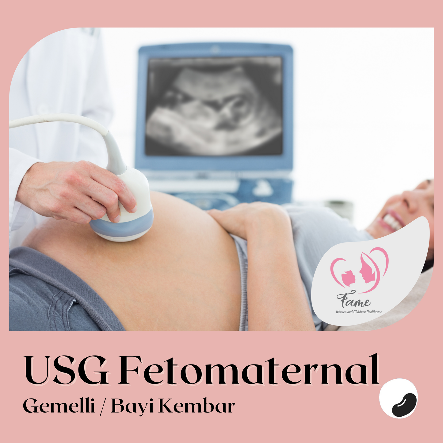 USG Fetomaternal Gemelli (Bayi Kembar)