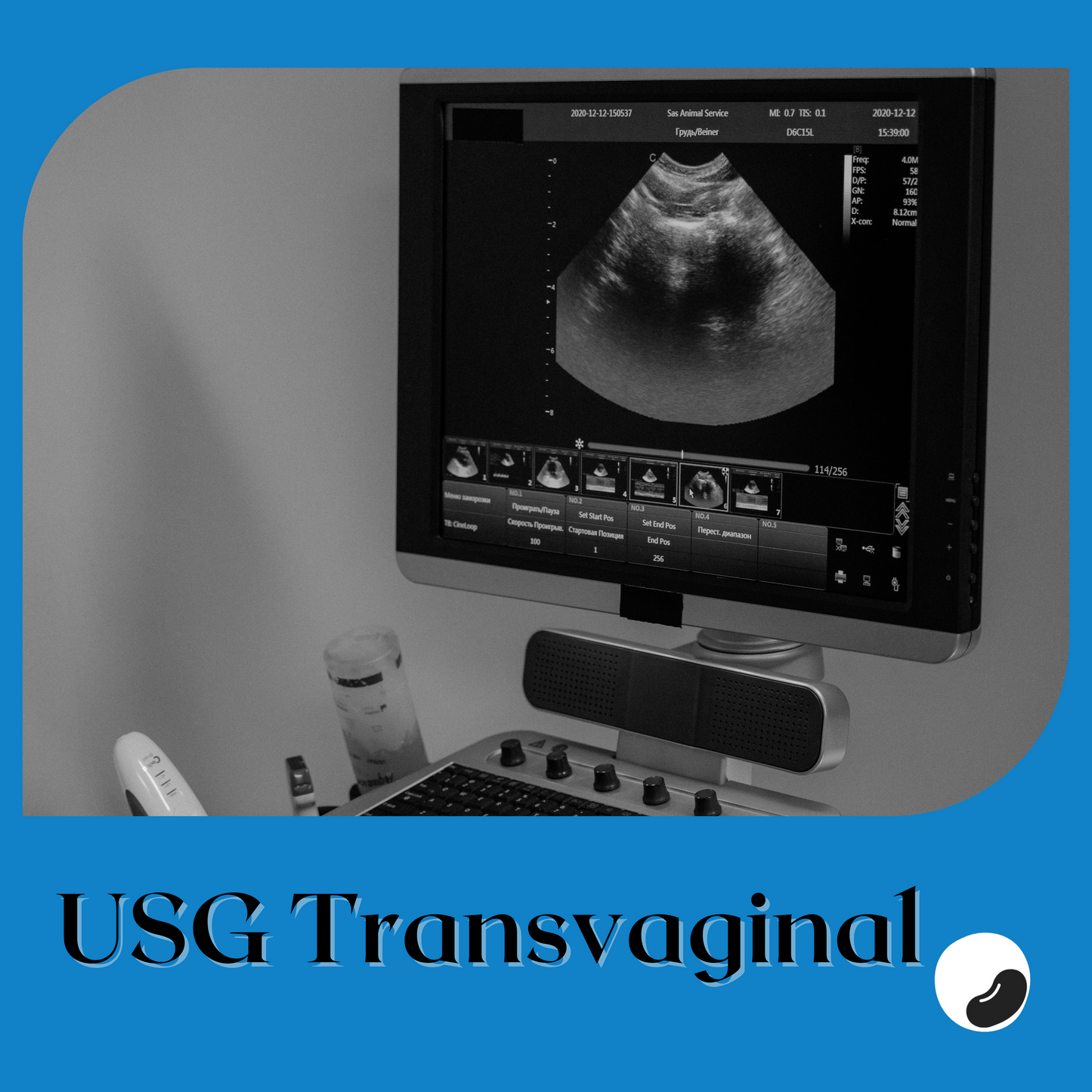 USG Transvaginal Promil - Non Print