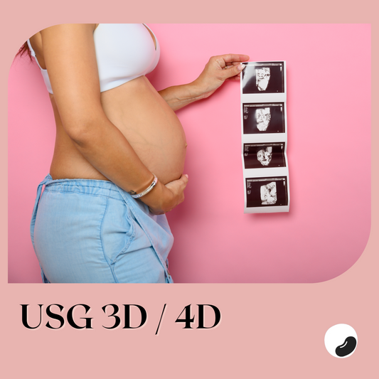USG 3D / 4D Kehamilan - Print