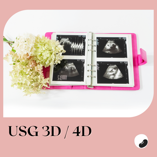 USG 3D / 4D Kehamilan - Non Print