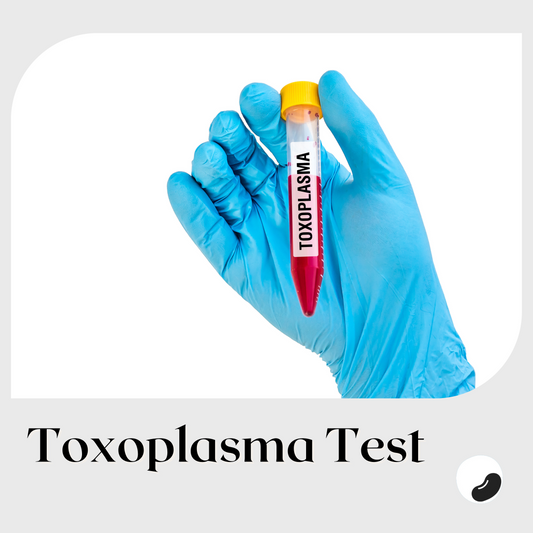 Toxoplasma Test