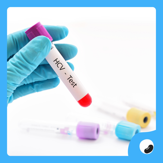 Anti-HCV Test