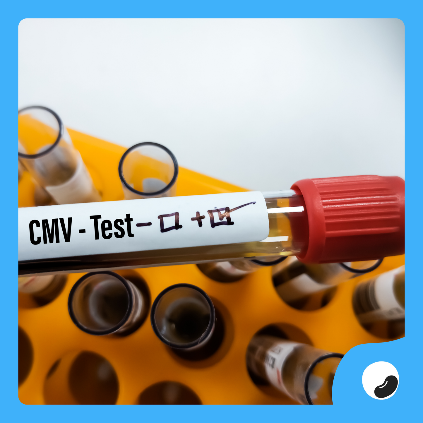 Pesan Layanan CMV (Cytomegalovirus) Test di PLans. – Plans.