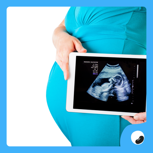 3D / 4D Pregnancy Ultrasound - Non Print