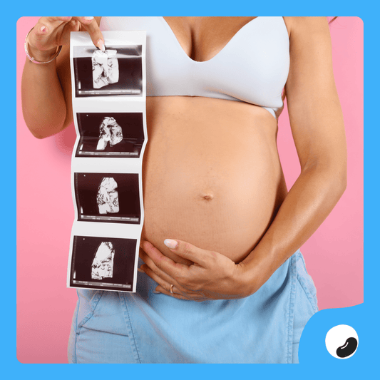 3D / 4D Pregnancy Ultrasound - Print